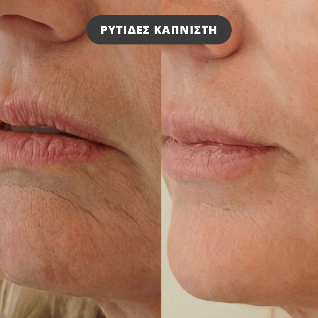 NAD+ Chrono Repair Serum (30ml)