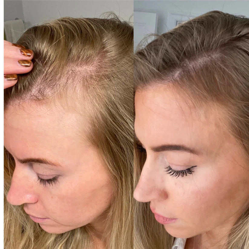 GrowTurn sérum repousse capillaire (100 ml)