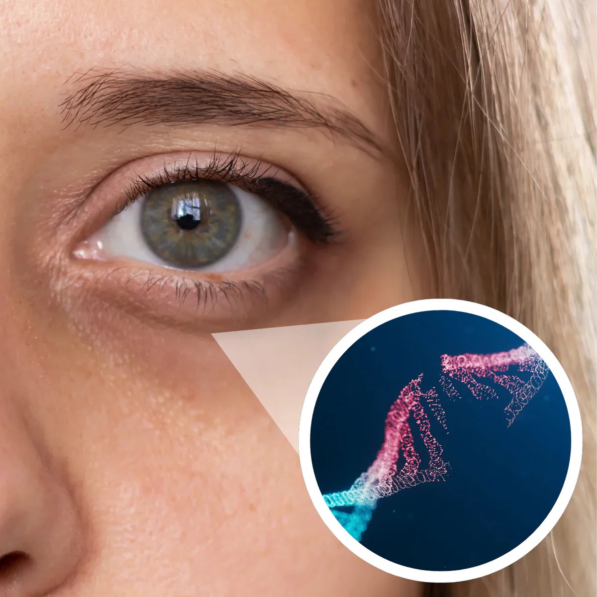 La fragmentation de l'ADN dans les fibroblastes sous-oculaires — la cause réelle des poches et ridules.