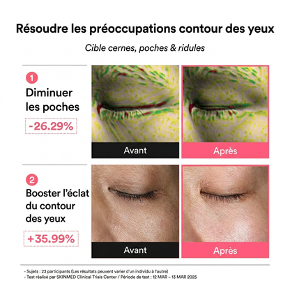 Patchs Yeux PDRN & Rétinal