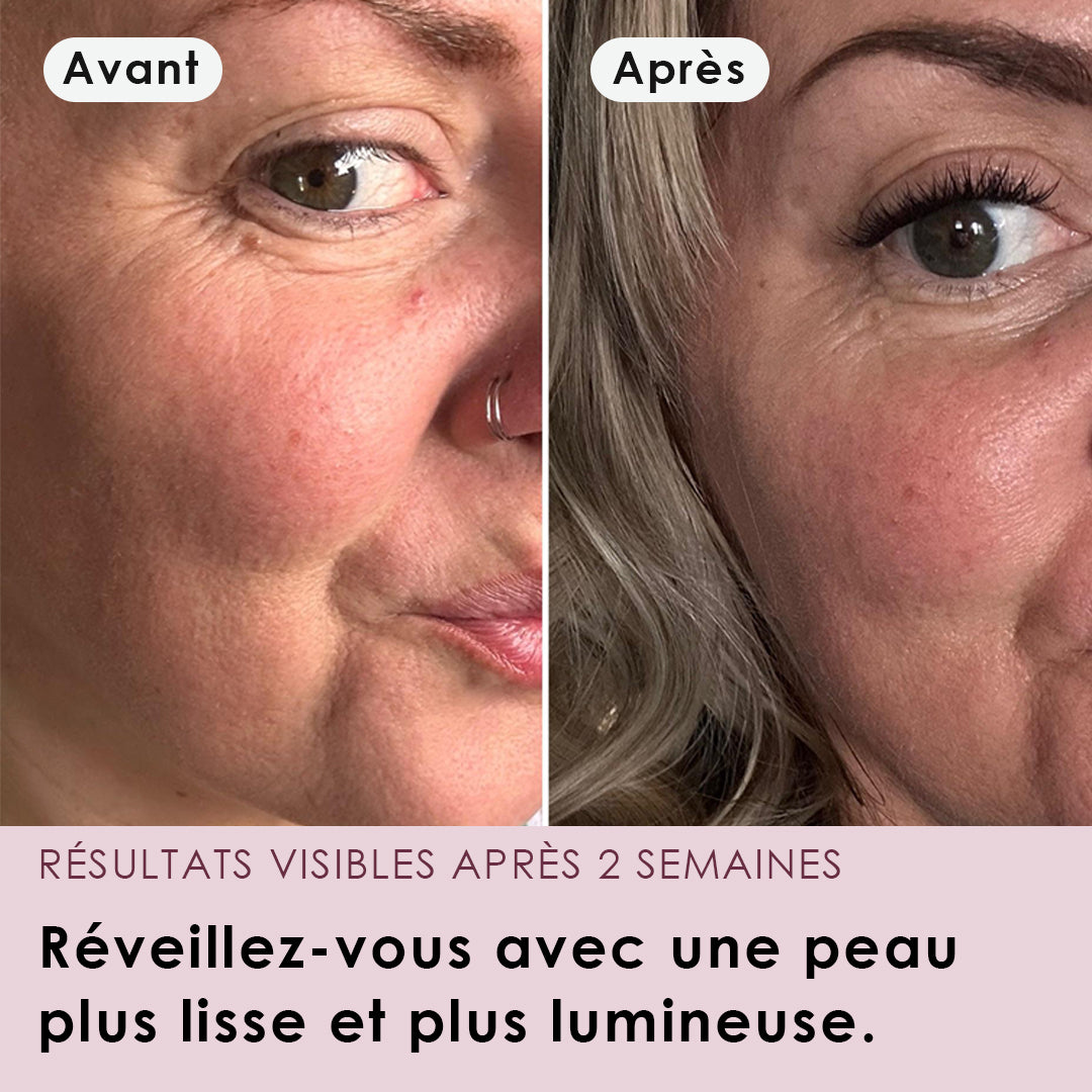 Masque Enveloppant Au Collagène