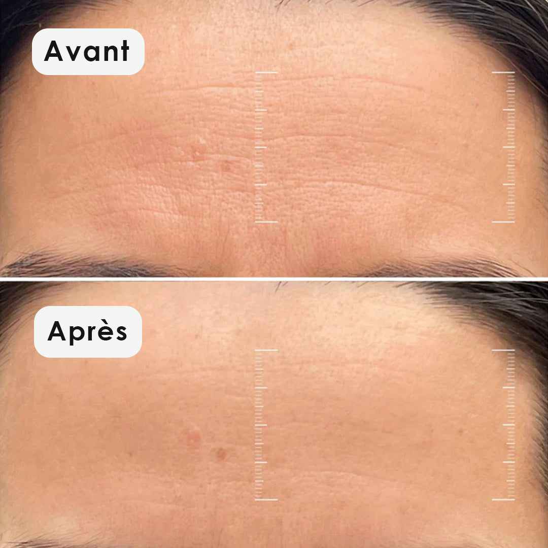 Masque Enveloppant Au Collagène