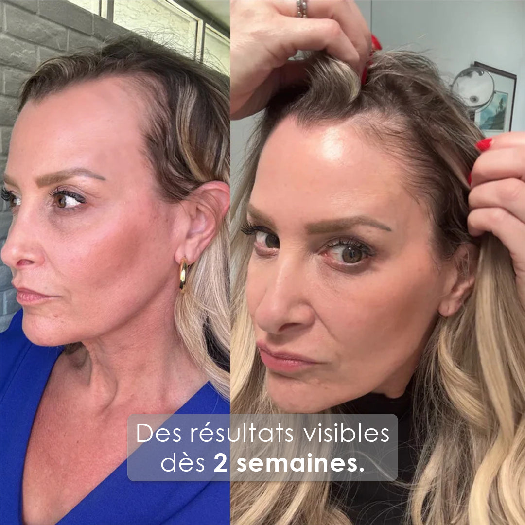 GrowTurn sérum repousse capillaire (100 ml)