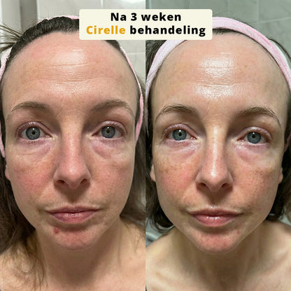 SilkLift Zijde-Peptiden Serum