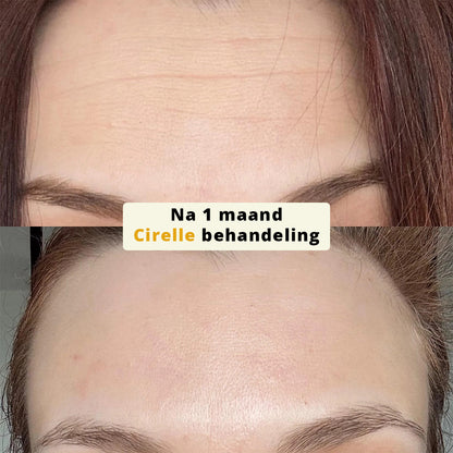 SilkLift Zijde-Peptiden Serum